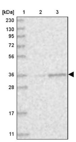 Pyruvate Dehydrogenase E1 beta subunit Antibody, Novus Biologicals 0.1mL;