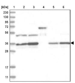 Pyruvate Dehydrogenase E1 beta subunit Antibody, Novus Biologicals 0.1mL;