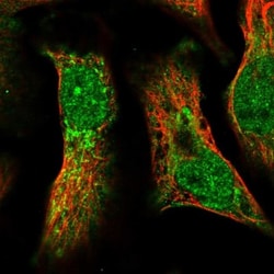 Pyruvate Dehydrogenase Phosphatase/PDP1/PPM2C Antibody, Novus Biologicals