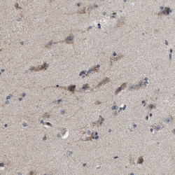 Pyruvate Dehydrogenase Phosphatase/PDP1/PPM2C Antibody, Novus Biologicals