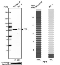 Pyruvate Dehydrogenase Phosphatase/PDP1/PPM2C Antibody, Novus Biologicals