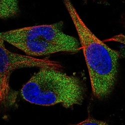 QARS Antibody, Novus Biologicals 0.1mL; Unlabeled:Antibodies, Polyclonal