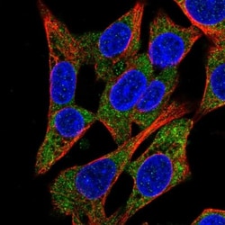 QARS Antibody, Novus Biologicals 0.1mL; Unlabeled:Antibodies, Polyclonal