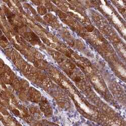 QARS Antibody, Novus Biologicals 0.1mL; Unlabeled:Antibodies, Polyclonal