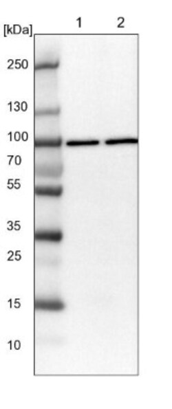 QARS Antibody, Novus Biologicals 0.1mL; Unlabeled:Antibodies, Polyclonal