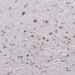 QDPR Antibody, Novus Biologicals 0.1mL; Unlabeled:Antibodies, Polyclonal