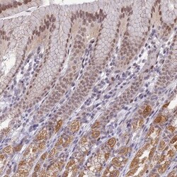 QIL1 Antibody, Novus Biologicals 25 &mu;L; Unlabeled:Antibodies, Polyclonal