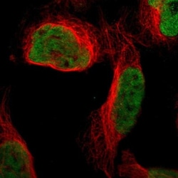 QKI/Quaking Antibody, Novus Biologicals 0.1mL; Unlabeled:Antibodies, Polyclonal