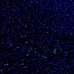 QKI/Quaking Antibody, Novus Biologicals 0.1mL; Unlabeled:Antibodies, Polyclonal