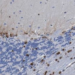 QKI/Quaking Antibody, Novus Biologicals 0.1mL; Unlabeled:Antibodies, Polyclonal