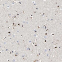 QKI/Quaking Antibody, Novus Biologicals 0.1mL; Unlabeled:Antibodies, Polyclonal