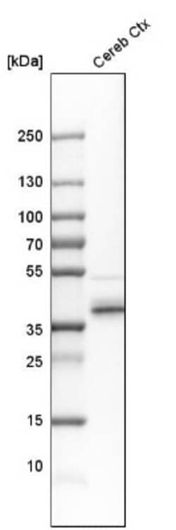 QKI/Quaking Antibody, Novus Biologicals 0.1mL; Unlabeled:Antibodies, Polyclonal