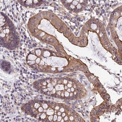 QRFP Antibody, Novus Biologicals:Antibodies:Primary Antibodies