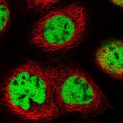 QRICH1 Antibody, Novus Biologicals 0.1mL; Unlabeled:Antibodies, Polyclonal