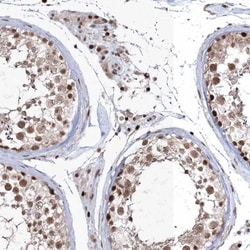 QRICH1 Antibody, Novus Biologicals:Antibodies:Primary Antibodies