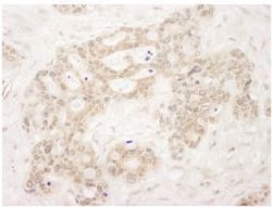 QSER1 Antibody, Novus Biologicals 0.1mL; Unlabeled:Antibodies, Polyclonal