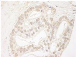 QSER1 Antibody, Novus Biologicals 0.1mL; Unlabeled:Antibodies, Polyclonal