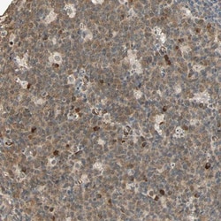 QSER1 Antibody, Novus Biologicals 25 &mu;L; Unlabeled:Antibodies, Polyclonal