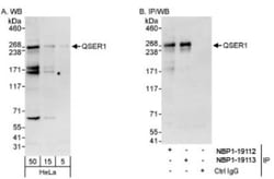 QSER1 Antibody, Novus Biologicals 0.1mL; Unlabeled:Antibodies, Polyclonal