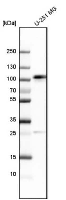 QSOX2 Antibody, Novus Biologicals 0.1mL; Unlabeled:Antibodies, Polyclonal