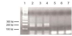 Novus Biologicals™ QuikChIP (with Loading Control) Kit (ChIP)