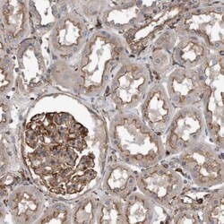 R-Spondin 3 Antibody, Novus Biologicals 0.1mL; Unlabeled:Antibodies, Polyclonal