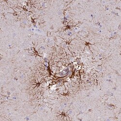 R3HDM4 Antibody, Novus Biologicals 25 &mu;L, Unlabeled:Antibodies, Polyclonal