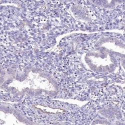 RAB11FIP5 Antibody, Novus Biologicals 0.1mL; Unlabeled:Antibodies, Polyclonal