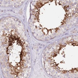 RAB11FIP5 Antibody, Novus Biologicals 0.1mL; Unlabeled:Antibodies, Polyclonal