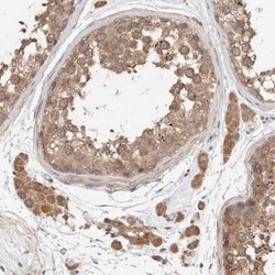 RAB14 Antibody, Novus Biologicals 0.1mL; Unlabeled:Antibodies, Polyclonal