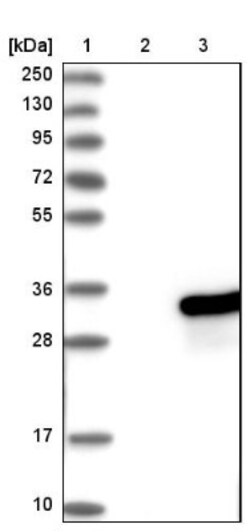 RAB21 Antibody, Novus Biologicals:Antibodies:Primary Antibodies