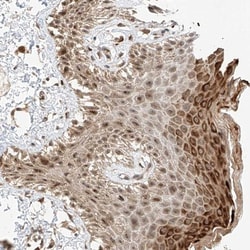 INTS11 Antibody, Novus Biologicals:Antibodies:Primary Antibodies