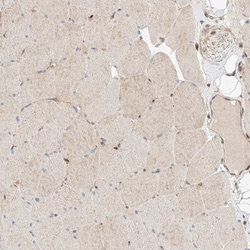 INTS11 Antibody, Novus Biologicals:Antibodies:Primary Antibodies