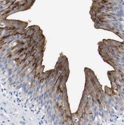 RAB27B Antibody, Novus Biologicals:Antibodies:Primary Antibodies