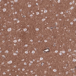 RAB27B Antibody, Novus Biologicals:Antibodies:Primary Antibodies