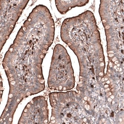 RAB27B Antibody, Novus Biologicals:Antibodies:Primary Antibodies