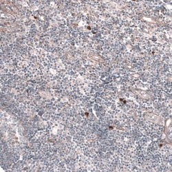 RAB27B Antibody, Novus Biologicals:Antibodies:Primary Antibodies