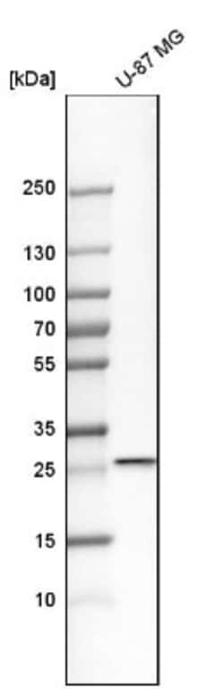 RAB27B Antibody, Novus Biologicals:Antibodies:Primary Antibodies