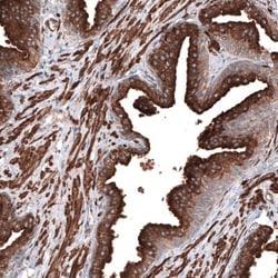 RAB27B Antibody, Novus Biologicals:Antibodies:Primary Antibodies