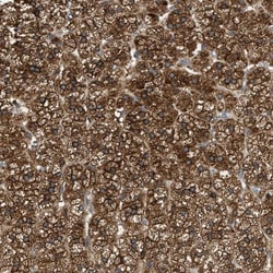 RAB31 Antibody, Novus Biologicals 0.1mL; Unlabeled:Antibodies, Polyclonal