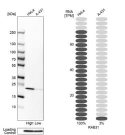 RAB31 Antibody, Novus Biologicals 0.1mL; Unlabeled:Antibodies, Polyclonal