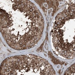 RAB3GAP1 Antibody, Novus Biologicals 25 &mu;L, Unlabeled:Antibodies, Polyclonal