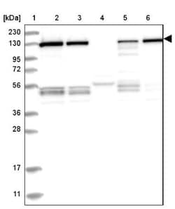 RAB3GAP1 Antibody, Novus Biologicals 25 &mu;L, Unlabeled:Antibodies, Polyclonal