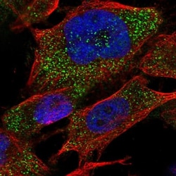 RAB3GAP2 Antibody, Novus Biologicals 0.1mL; Unlabeled:Antibodies, Polyclonal