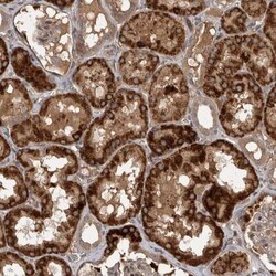 RAB3GAP2 Antibody, Novus Biologicals 25 &mu;L | Buy Online | Novus Biologicals | Fisher Scientific