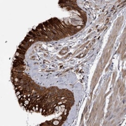 RAB3GAP2 Antibody, Novus Biologicals 0.1mL; Unlabeled:Antibodies, Polyclonal