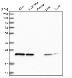 RAB3GAP2 Antibody, Novus Biologicals 0.1mL; Unlabeled:Antibodies, Polyclonal