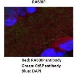RAB3IP Antibody, Novus Biologicals 100&mu;L; Unlabeled:Antibodies, Polyclonal