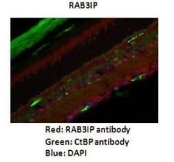 RAB3IP Antibody, Novus Biologicals 100&mu;L; Unlabeled:Antibodies, Polyclonal
