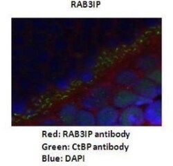 RAB3IP Antibody, Novus Biologicals 100&mu;L; Unlabeled:Antibodies, Polyclonal